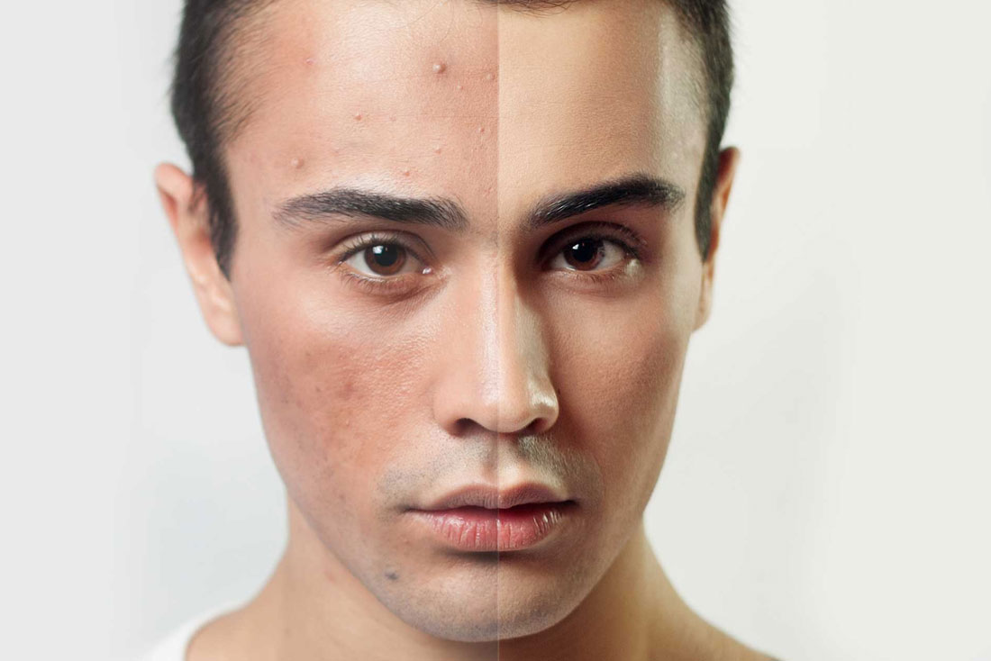 When to Call the Dermatologist